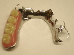 Co-Cr-Cast-Metal-Partial-Denture