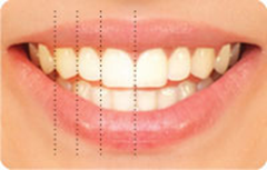 Relative-tooth-dimension-n-proportion