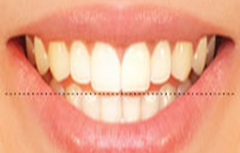 horizontal-alignment