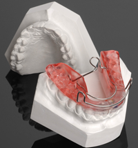 myofunctional-app--Bionator