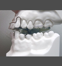 myofunctional-app-Twin-Block