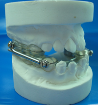 myofunctional-app-herbst