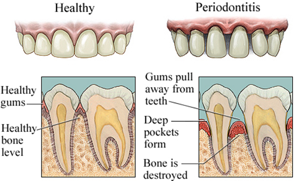 periodontics