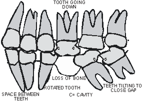 tooth-going