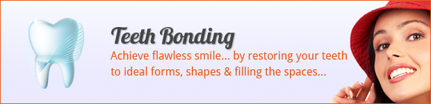 bonding-banner