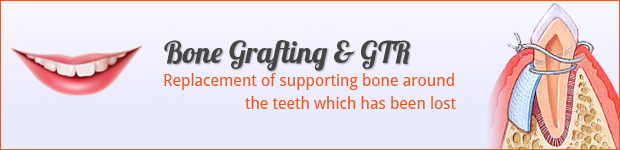 bone-graft-gtr
