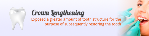 crown-lengthening