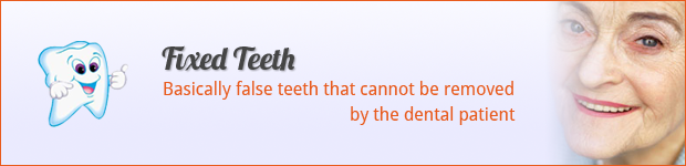 fixed-teeth
