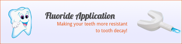 fluoride-application