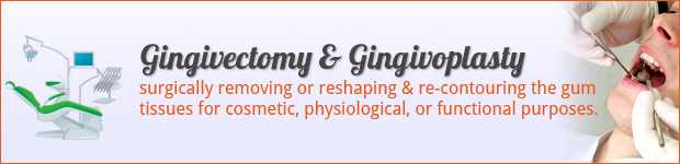 gingivectomy-gingivoplasty