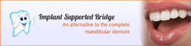 implant-supported-bridge