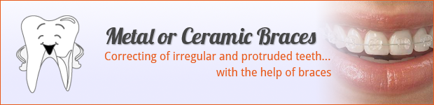 metal-ceramic-braces