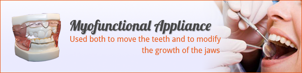 myofunctional-appliance