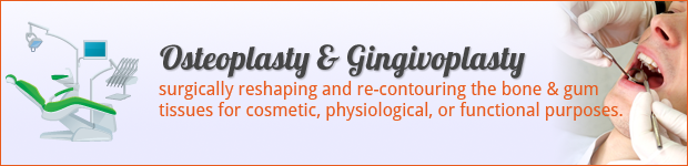osteoplasty-gingivoplasty