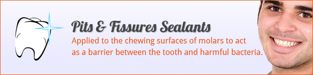 pits-and-fissures-sealants
