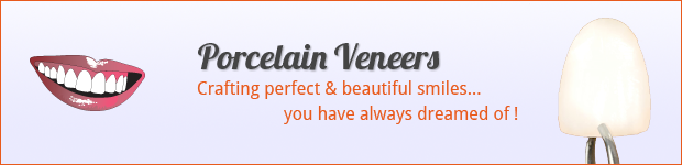 porcelain-veneers-banners