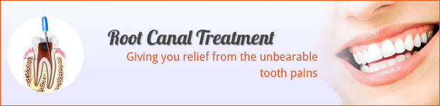 root-canal-treatment-banner