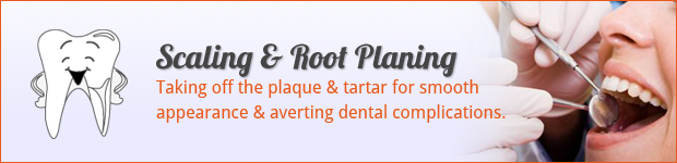 scaling-root-planingof-teeth