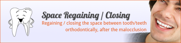 space-regaining-closing